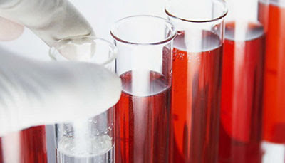 Xét nghiệm máu có thể phát hiện sớm ung thư phổi